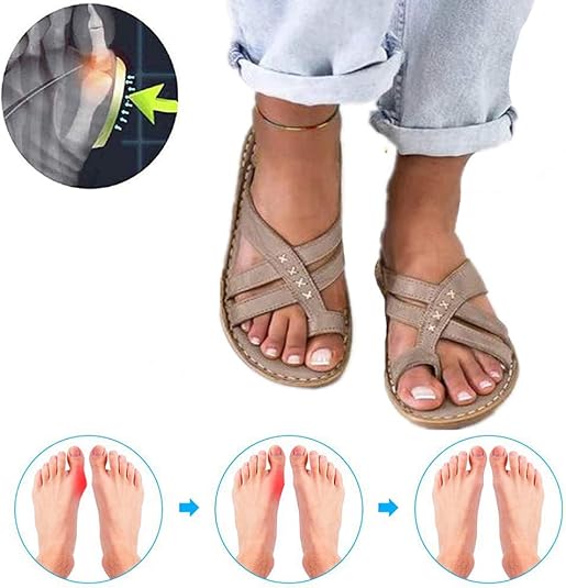 Wygwlg Bunion Sandals for Women Comfy, Ladys Big Toe Bone Orthopedic