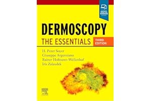 Dermoscopy: The Essentials