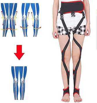 Amazon Co Jp O Xタイプノックニーバンデージ 調整可能な脚矯正弓脚ユニセックスo X姿勢矯正ベルトリカバリー美脚矯正大人用 スポーツ アウトドア