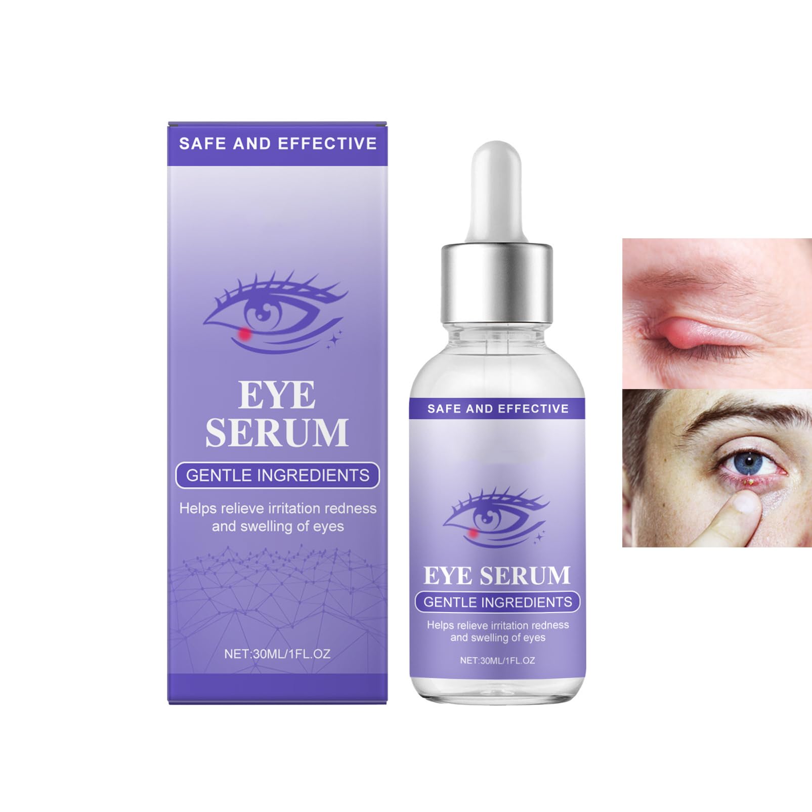 30ml StyeEyeTreatment,MyceliaBlepharitis,RelievePuffinessSerum,Eye Drops for Infected Eyes for StyesChalazion&Blepharitis,Daily Cleanser For Dry Eye Relief