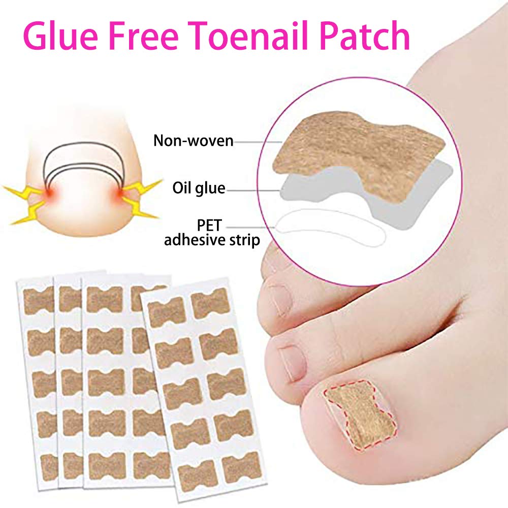 3 Set Glue Free Toenail Patch - Ingrown Toenail Correction Sticker Professional Pedicure for Men Women Toenail Care Tool: Beauty