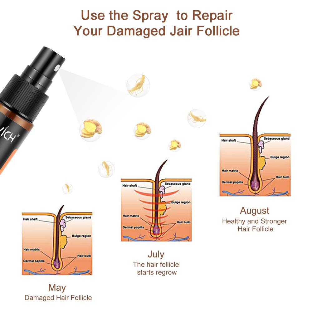 Hair Grow Spray, Anti Hair Loss, Thinning, Balding, Natural Ingredients Hair Regrowth Treatment for Stronger, Thicker, Longer Hair Grow, Repair Hair Follicles, All Hair Types, Men and Women : Beauty
