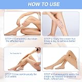 ACWOO Urea Cream 40% Foot Hand Cream 150g for Cracked Heels Dry Skin Callus view 6