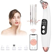 Blackhead Remover Vacuum Pore Cleaner with Camera - Visual Beauty Device with 3 Adjustable Suction Power and 5…