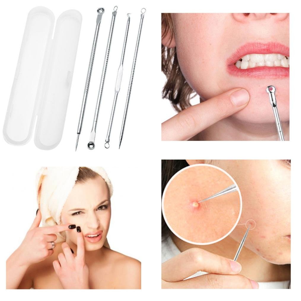 Sixcup Blackhead Remover Kit 4 In1 Acne Pimple Comedone Extractor