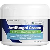 Charmpoo Antifungal Cream for Jock Itch: Anti Fungal Cream for Itchy Skin Relief Extra Strength - Ringworm Treatment for Humans - Athletes Foot Treatment for Feet 3.4 oz, 100g, White
