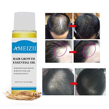 Amazon Com Romantic Bear Ginger Hair Growth Essence Liquid