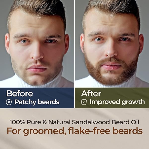 GYA LABS SANDALWOOD BEARD OIL FOR MEN GROWTH – 100% PURE NATURAL BEARD GROWTH OIL FOR MEN WITH ORGANIC ARGAN & JOJOBA – MOISTURIZES, SOFTENS & STRENGTHENS (1 FL OZ)