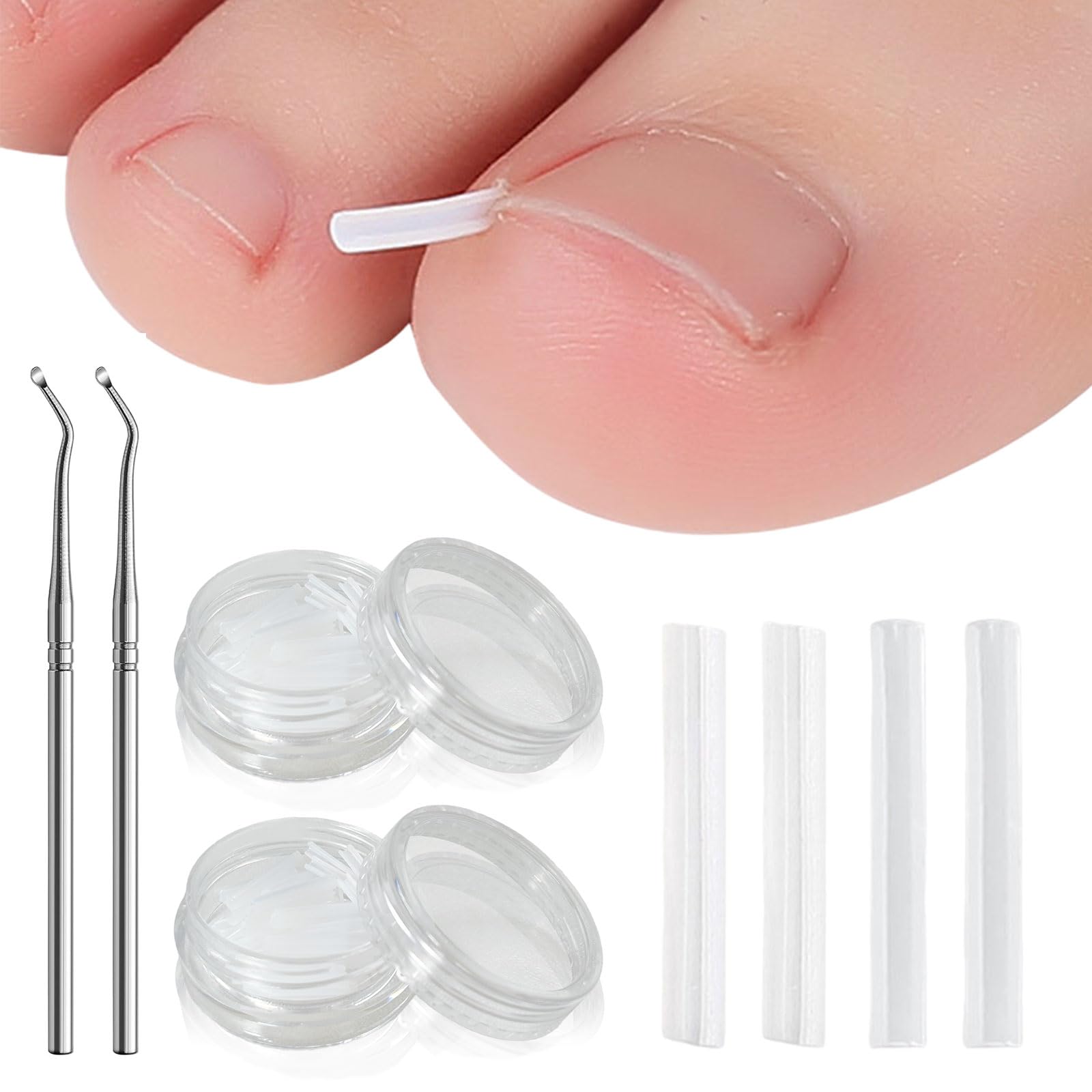 UILYNIU 102 Pcs Ingrown Toenail Corrector Set, Professional Tools for Thick Nails, Toenail Corrector Kit for Women & Men Foot Care (Transparent)