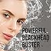 Blackhead Remover Set [FREE BRUSH & TWEEZERS] Charcoal Mask with Professional for Blackheads - Black Mask for Deep Cleansing [REMOVES ACNE] Best Facial Mud Mask - Peel Off Extractor Tool Kit (Set)