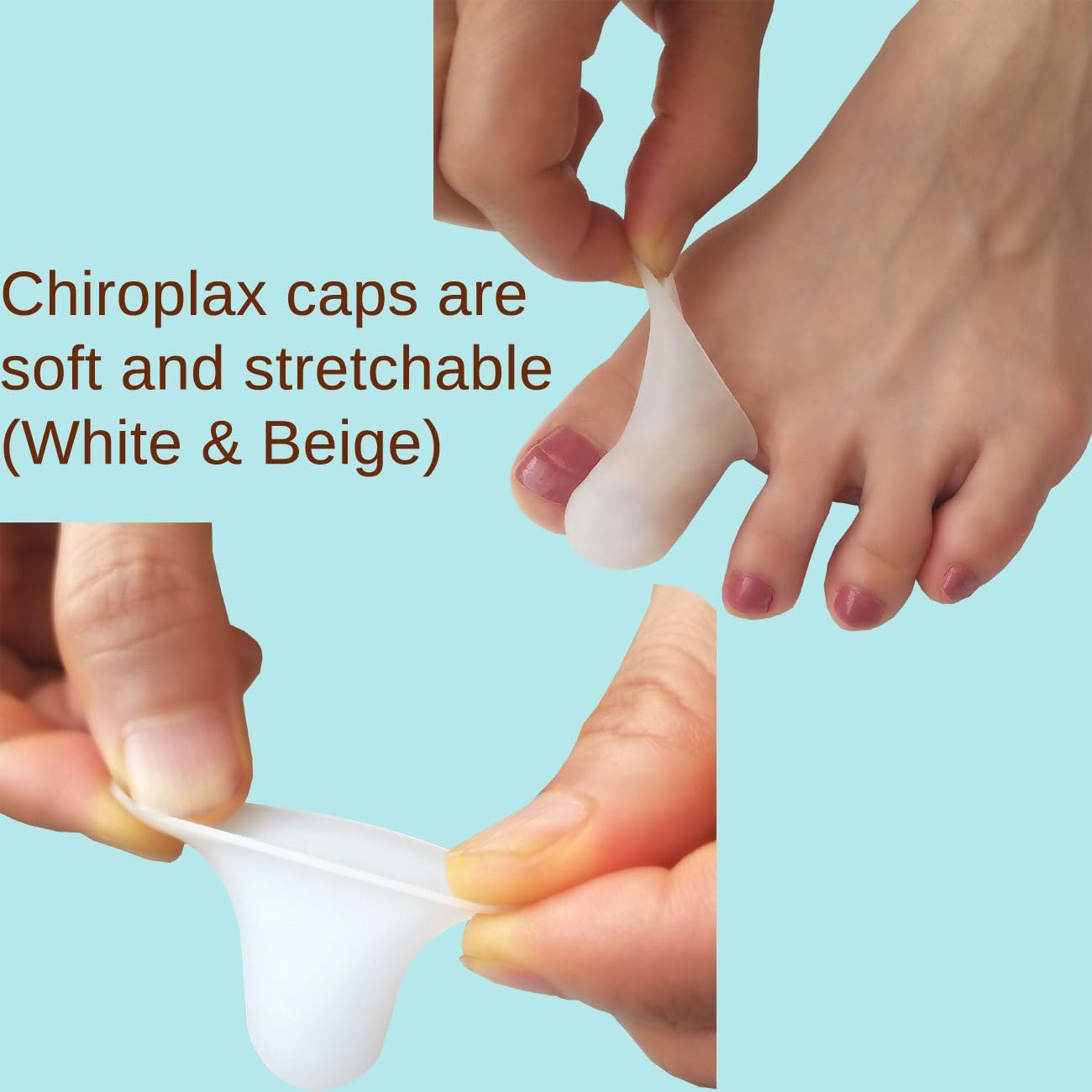 Chiroplax Gel Toe Cap (6 Caps+ Pouch) Toe Sleeve Protector Cushions Pads Guard Separator for Bunion Hammer Toe Callus Corn Blister Missing Ingrown Nails Ballet Pointe (Large - 6 Pack, Beige): Health & Personal Care
