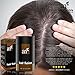 Art Naturals Hair Fusion - Hair Building Fibers 25 Grams to fill Thinning, Sparse or Balding Areas - Made of natural, colored Keratin Fibers that blend undetectable into existing hair …