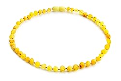 Amber Guru Baltic Amber Necklace
