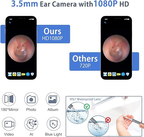 Amazon Com Manwe Ear Wax Removal 3 5mm Visual Wireless Otoscope Earwax Removal Tool 1080p Hd Wifi Ear Endoscope With 6 Led Lights For Iphone Ipad Android Phones Ear Cleaner With Camera For Adults