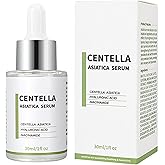 Centella Asiatica Soothing Redness Serum,Facial Serum For Troubled & Sensitive Skin-Including Chamomile Extract, Niacinamide,Aloe Vera Leaf Extract,Hydrate And Moisturize(30ml/1.01Fl Oz)