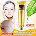 Acne Scar Removal Cream, Skin Repair Cream Scar Cream Gel Scar Treatment for Face and Body Scar Acne Spots Stretch Marks 30ml