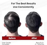 HOMESTA Red Light Therapy Hair Growth Cap for Men Women Laser Follicle view 6
