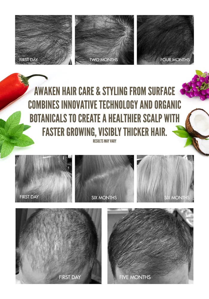 Surface Hair - Awaken Kit: Shampoo, Conditioner, Scalp Elixir and Therapeutic Treatment - for Thinning Hair, Hair Loss and Thickening