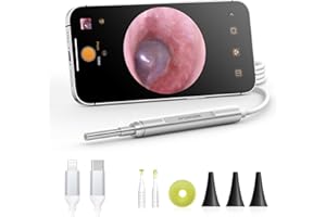 AnyScope Digital Otoscope Compatible with iPhone and Android Devices, HD Ear Camera with Ear Wax Removal Tools, Video Ear Sco