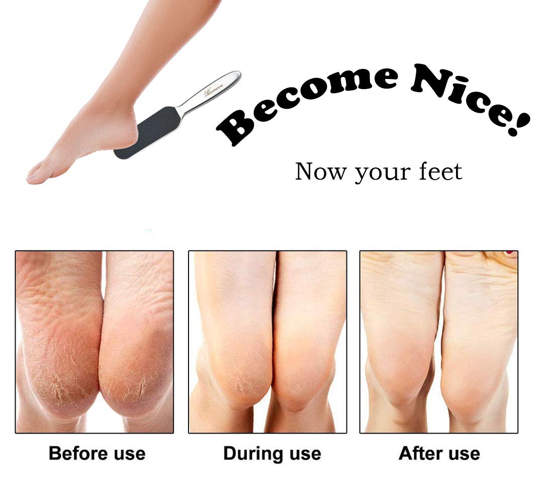 Professional Pedicure Foot File - Reusable Stainless Steel Cracked Skin Corns Callus Remover Feet Rasp : Beauty