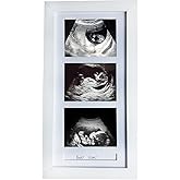 trlry Triple Ultrasound Picture Frames, Sonogram Picture Frame 3 Photos,Pregnancy Announcements,Pregnancy Gifts for First Time Moms,First Time Mom Gift,White,Ultrasound Photo Album