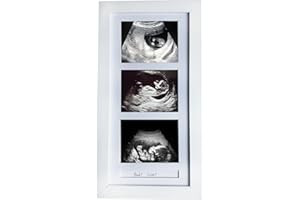 trlry Triple Ultrasound Picture Frames, Sonogram Picture Frame 3 Photos,Pregnancy Announcements,Pregnancy Gifts for First Time Moms,First Time Mom Gift,White,Ultrasound Photo Album