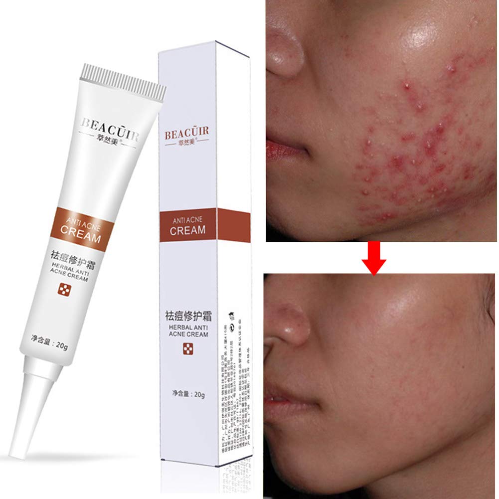 neutrogena rapid tone repair face moisturizer