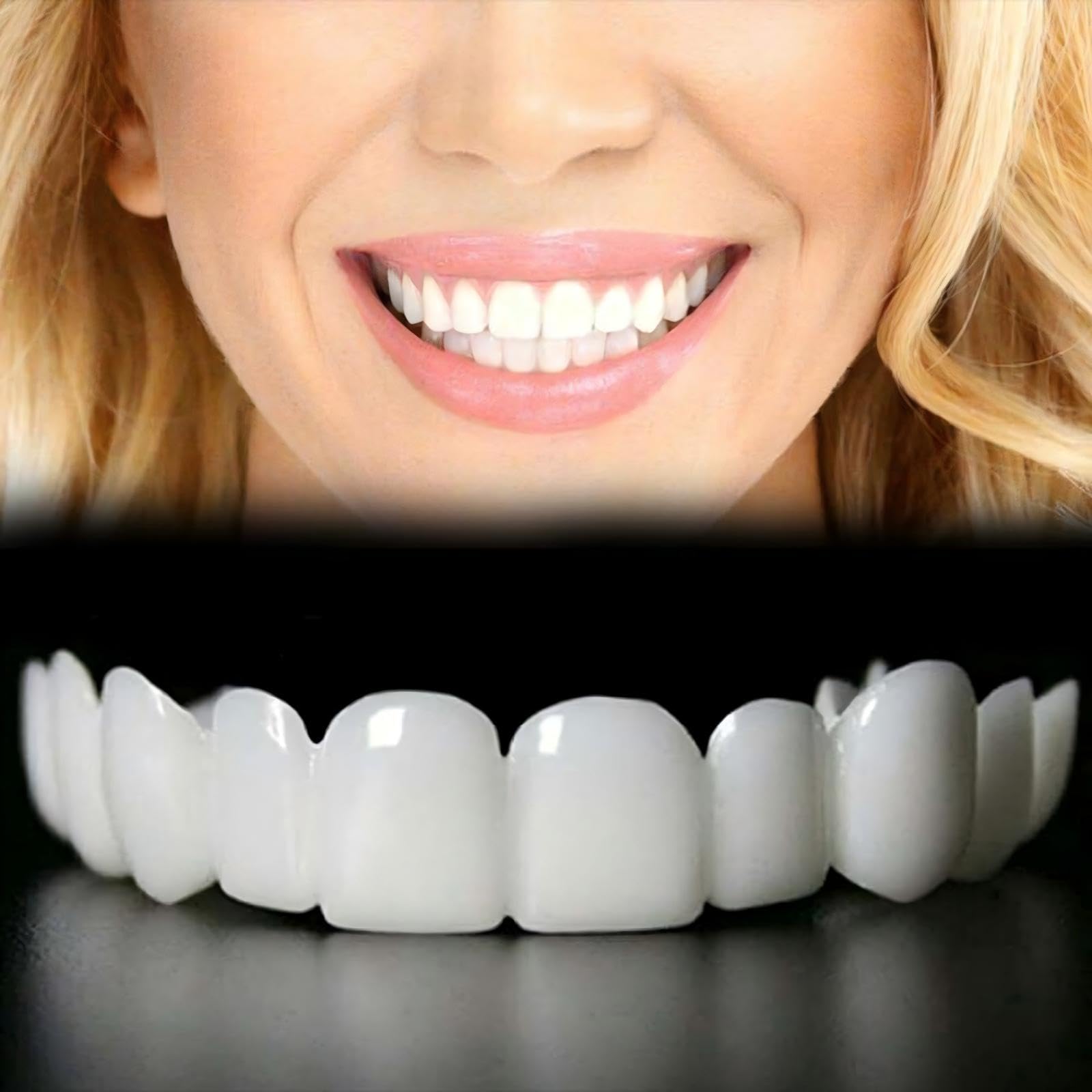 Photo 1 of 2 Pairs of Smile Supports, Quickly Restore Smile and Regain Confidence (White) Adjustable Comfort.