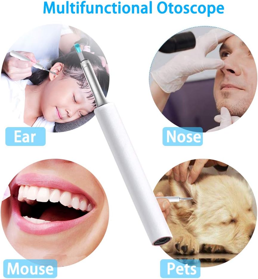 BEBIRD Ear Wax Removal Endoscope Otoscope, Earwax Remover Tools, Scope, with 1080P FHD Camera, 6 Led Lights, Wireless Connected, Compatible with iPhone, iPad, Android Smart Phones & Tablets (White) : Electronics