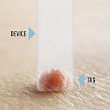 TagCure Skin Tag Removal Kit - Includes 10 Tag Bands, 10 Swabs & 10 Plasters view 4