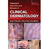 Fitzpatrick's Color Atlas and Synopsis of Clinical Dermatology, Ninth Edition