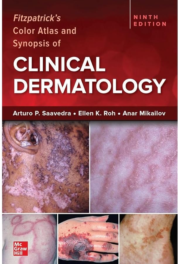 Skin Disease: Diagnosis and Treatment: 9780323442220: Medicine