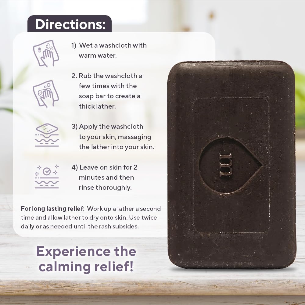 Marie Originals Eczema Face Soap Body Wash Bar – All Natural Psoriasis, Dermatitis Treatment for Dry Itchy Flaky Skin Relief – Gentle Detoxifying, Healing, Anti-Itch, Cleansing Skincare (Pack of 2)