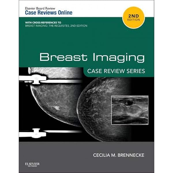 Radiology Case Review Series: Breast Imaging: 9780071787192