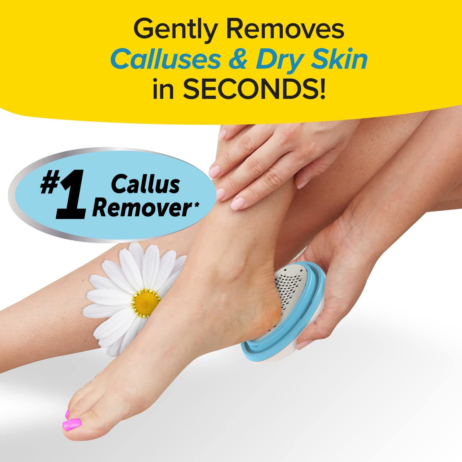 PedEgg Classic Callus Remover, As Seen On TV, New Look, Safely & Painlessly Remove Tough Calluses Dry Skin to Reveal Smooth Soft Feet, 135 Precision Micro-Blades, Traps Shavings, White, 3357, 4''
