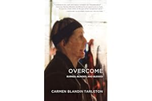 Overcome: Burned, Blinded, and Blessed