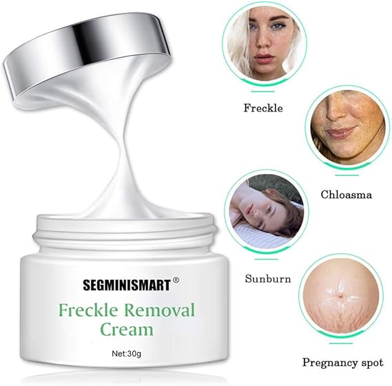 segminismart freckle cream