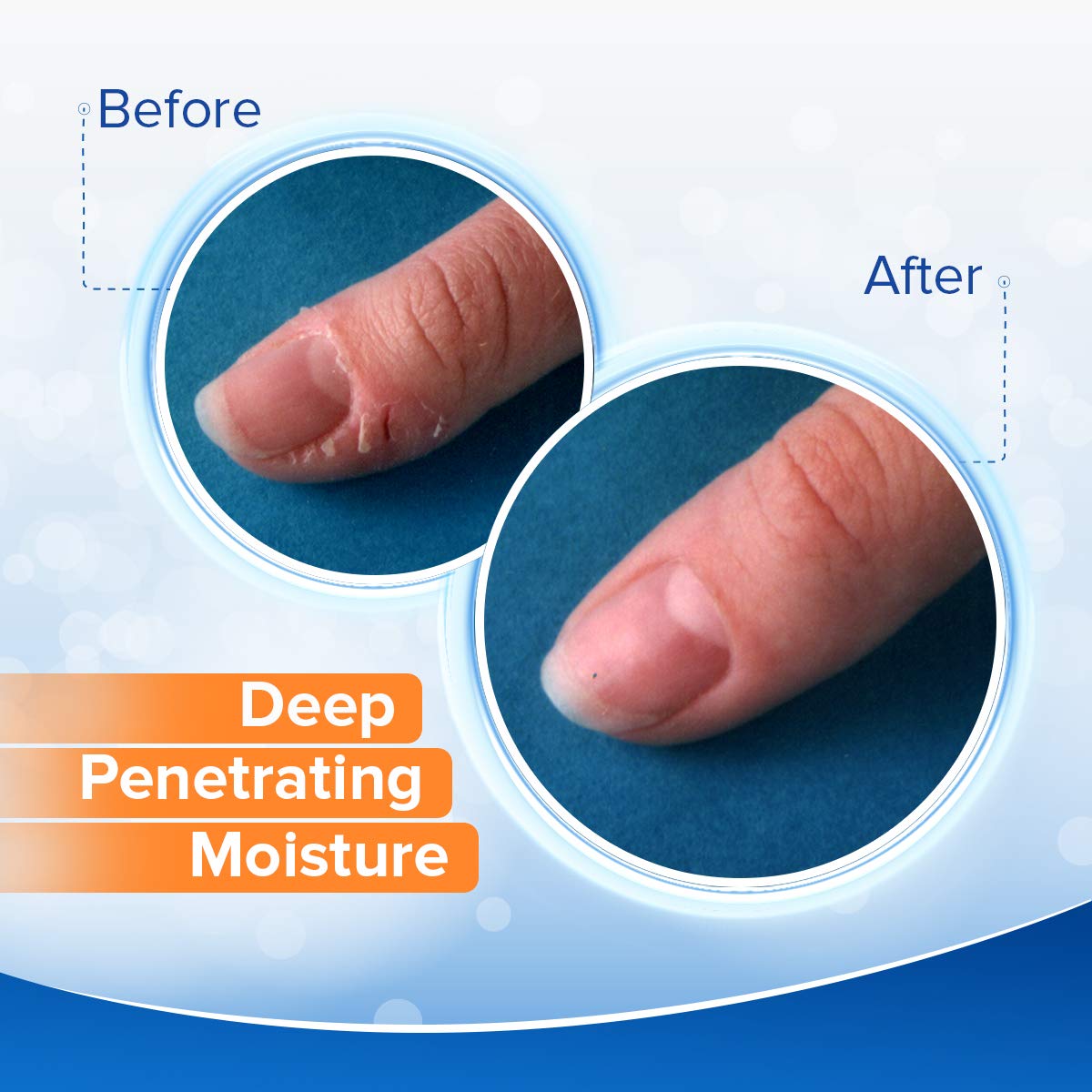 Dermal Therapy Finger Care Cream – Hydrating Treatment Repairs Skin to Heal Dry, Cracked Fingertips Resulting from Frequently Washed/Cleaned Hands | 20% Urea and 6% Alpha Hydroxy Acids | 0.6 fl. oz : Beauty