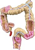 VERIMP Colorectal Pathology Model, Gastrointestinal