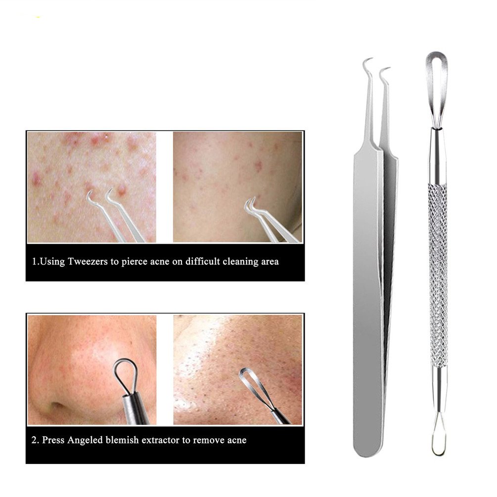 Blackhead Remover Tools, Excellent for Acne Treatment, Pimple Popping, Blackhead Extraction, Zit Removing, Blemish Removal, IOQSOF Blemish Pimple Whitehead Blackhead Acne