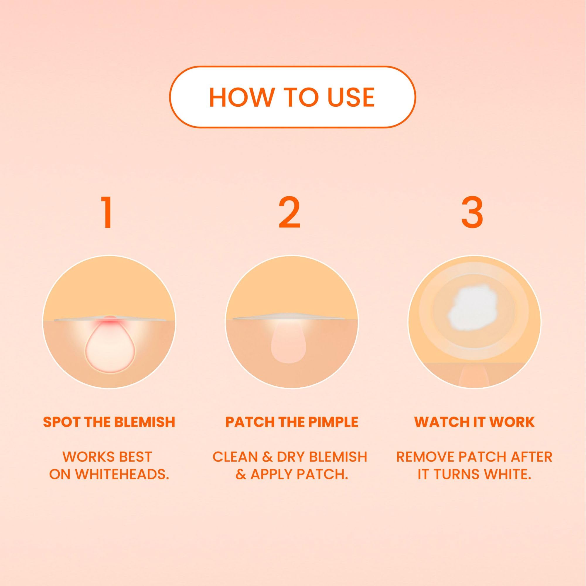 Biore Pimple Patches, Cover & Conquer Blemish Patch, Medical Grade Ultra-Thin Hydrocolloid for Covering Zits and Blemishes, HSA/FSA Approved, 30 Count