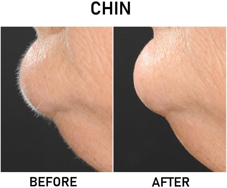 lilibeth facial razor