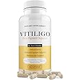 Dermawonder Vitiligo Capsules (60 Count) Effective Vitiligo Supplement, Reduce White Spots & Improve Skin Pigmentation Support, for All Skin & Reduce White Spots on Skin and Tinted Skin