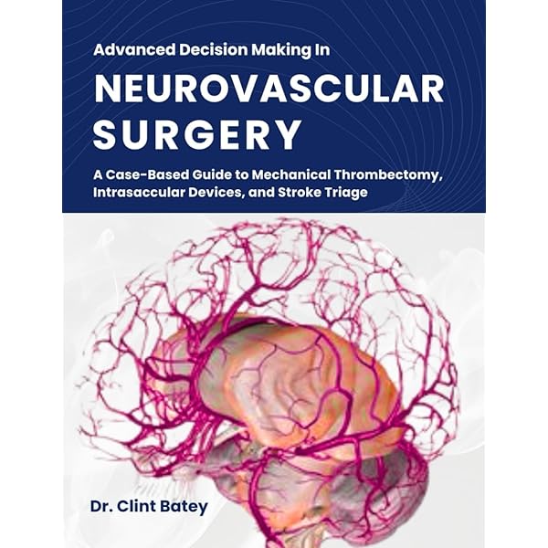 健康・医学 Decision Making in Neurovascular Disease Decision Making in Neurovascular Disease: order now in the Thieme