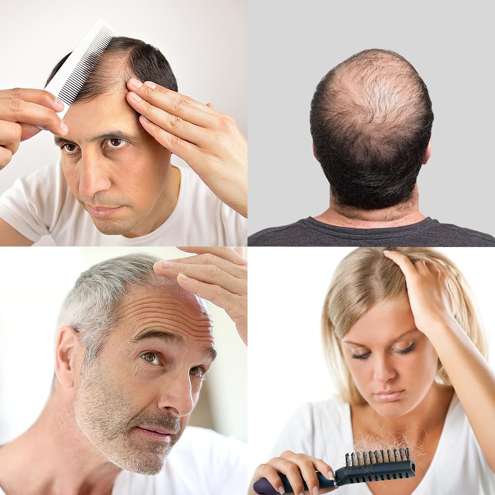 Noverlife Powder Spray Bottles, 12.5G Hairdressing Tools Hair Building Fiber Spraying Bottle, Powder Duster Applicator Nozzle Pump Hair Loss Sprayer Atomizer, Dry Glitter/Mica Spray Pump Dispenser