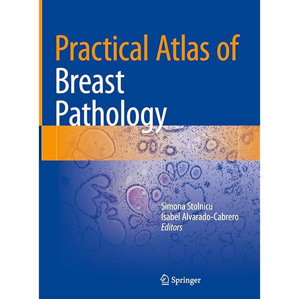 Atlas of Breast Surgery: Ismail Jatoi: 9783540243519: Amazon