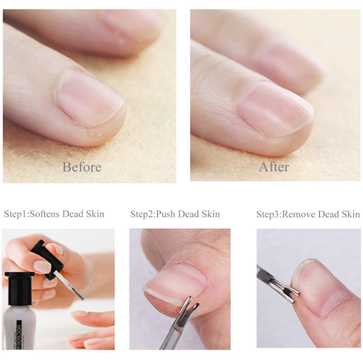 6 PCS Cuticle Pusher and Cutter Set, Dead Skin Nail Cleaner Tools, Professional Stainless Steel Cuticle Remover Kit, Cutter and Trimmer Manicure and Pedicure Tools for Fingernail and Toenails: Beauty