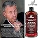 Art Naturals 2 Pack - Scalp18 Coal Tar Therapeutic Anti Dandruff Shampoo 16 oz - Helps clear symptoms of Psoriasis, Eczema, Itchy Scalp & Dandruff - Made in USA with Natural & Organic Ingredients