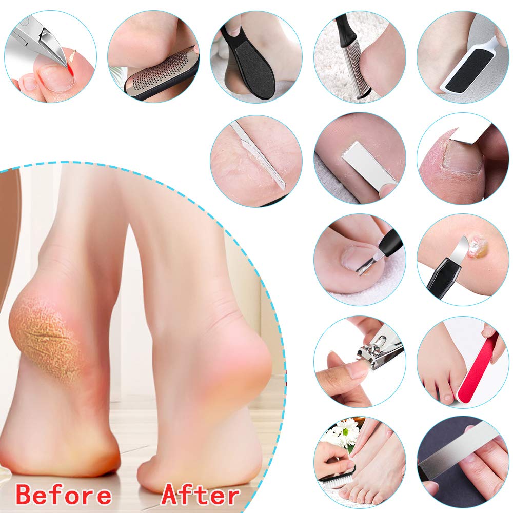 16 PCS Foot File Professional Pedicure Tools Set, Yotako Foot Spa Kit Callus Remover Scrubber, Exfoliating Pedicure Supplies and Nail Toenail Clipper Foot Care Kit : Beauty