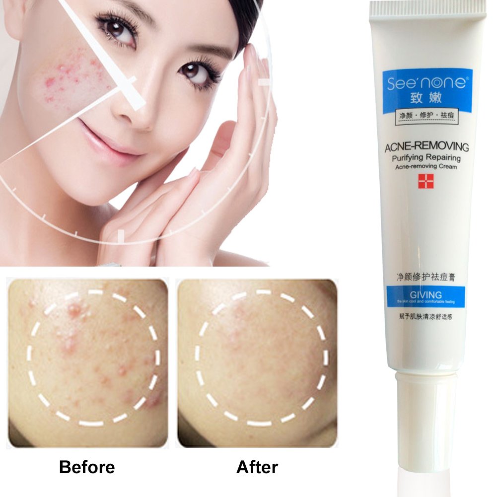 bb cream for acne scars